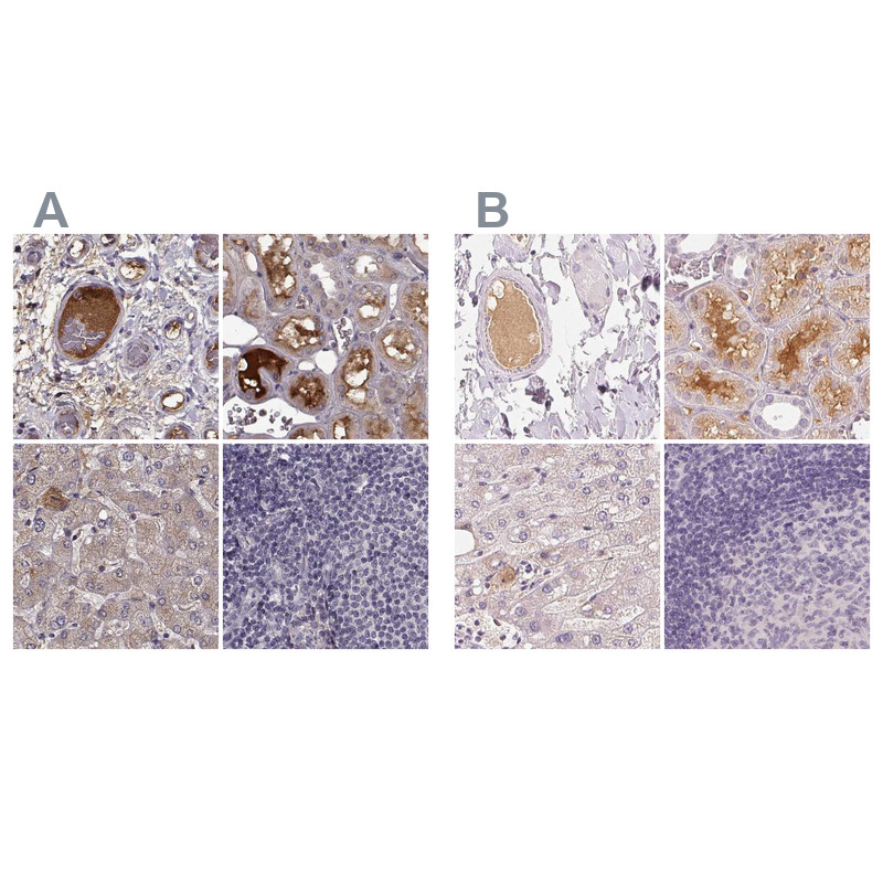 Immunohistochemical staining of human colon, kidney, liver and lymph node using Anti-AFM antibody HPA052437 (A) shows similar protein distribution across tissues to independent antibody HPA017006 (B).