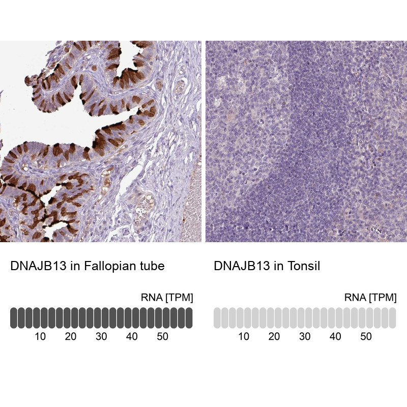 Immunohistochemistry analysis in human fallopian tube and tonsil tissues using Anti-DNAJB13 antibody. Corresponding DNAJB13 RNA-seq data are presented for the same tissues.