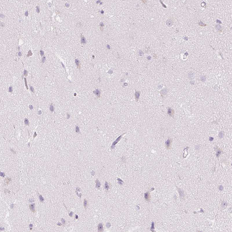 Immunohistochemical staining of human cerebral cortex shows no positivity in neurons as expected.