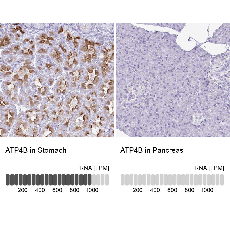 Immunohistochemistry analysis in human stomach and pancreas tissues using Anti-ATP4B antibody. Corresponding ATP4B RNA-seq data are presented for the same tissues.