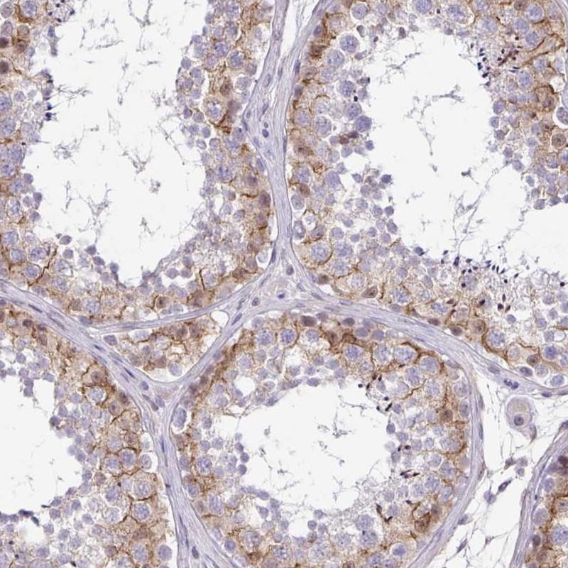 Immunohistochemical staining of human testis shows membrane positivity in seminiferus ducts.