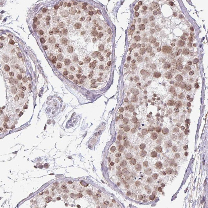 Immunohistochemical staining of human testis shows moderate nuclear positivity in cells in seminiferous ducts.