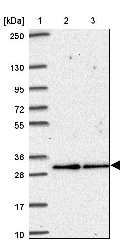 Lane 1: Marker [kDa] 250, 130, 95, 72, 55, 36, 28, 17, 10<br/>Lane 2: Human cell line RT-4<br/>Lane 3: Human cell line U-251MG sp