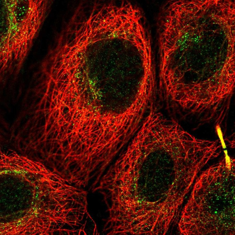 Immunofluorescent staining of human cell line A-431 shows localization to cytosol & cytokinetic bridge.