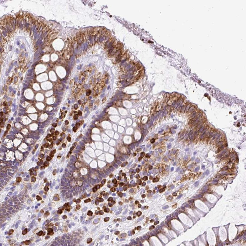 Immunohistochemical staining of human colon shows strong cytoplasmic positivity in glandular cells.