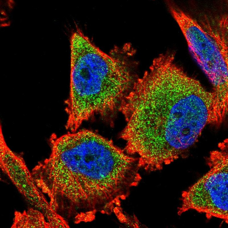 Immunofluorescent staining of human cell line U-251 MG shows localization to cytosol.