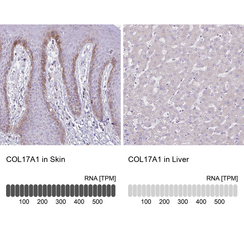 Immunohistochemistry analysis in human skin and liver tissues using HPA052963 antibody. Corresponding COL17A1 RNA-seq data are presented for the same tissues.