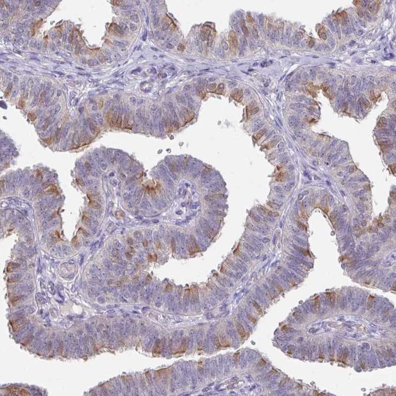 Immunohistochemical staining of human fallopian tube shows distinct positivity in apical membrane of ciliated cells.