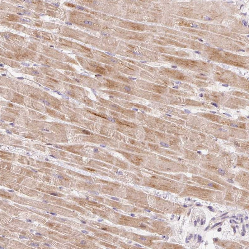 Immunohistochemical staining of human heart muscle shows moderate cytoplasmic positivity in myocytes.