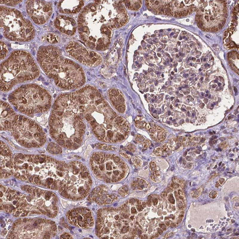 Immunohistochemical staining of human kidney shows strong cytoplasmic positivity in renal tubules.