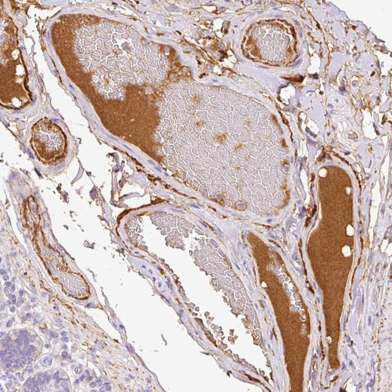 Immunohistochemical staining of human duodenum shows positivity in plasma.