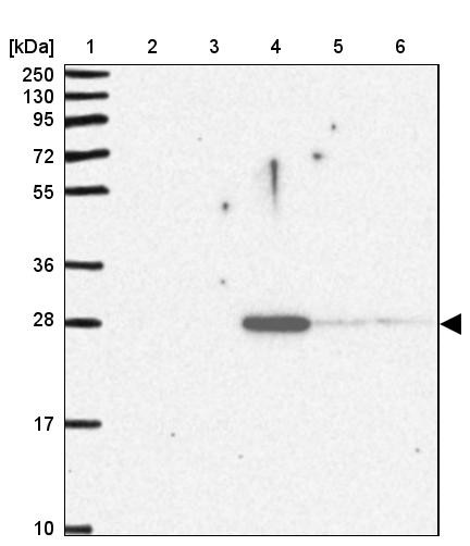 Lane 1: Marker [kDa] 250, 130, 95, 72, 55, 36, 28, 17, 10<br/>Lane 2: Human cell line RT-4<br/>Lane 3: Human cell line U-251MG sp<br/>Lane 4: Human plasma (IgG/HSA depleted)<br/>Lane 5: Human liver tissue<br/>Lane 6: Human tonsil tissue