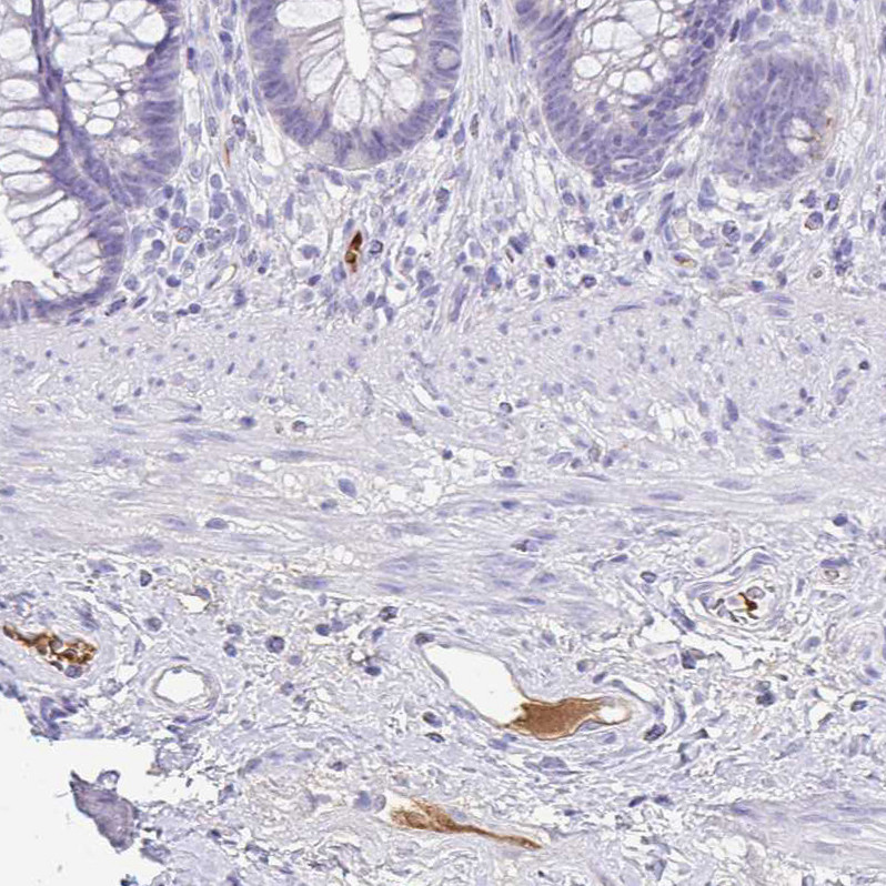 Immunohistochemical staining of human rectum shows moderate positivity in plasma in blood vessels.