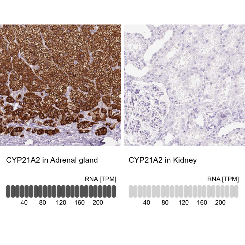 Immunohistochemistry analysis in human adrenal gland and kidney tissues using HPA053371 antibody. Corresponding CYP21A2 RNA-seq data are presented for the same tissues.