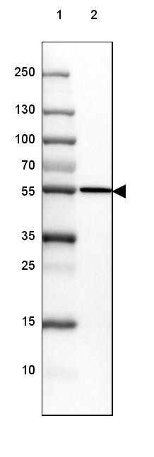 Lane 1: Marker [kDa] 250, 130, 100, 70, 55, 35, 25, 15, 10<br/>Lane 2: Human Adrenal Gland tissue