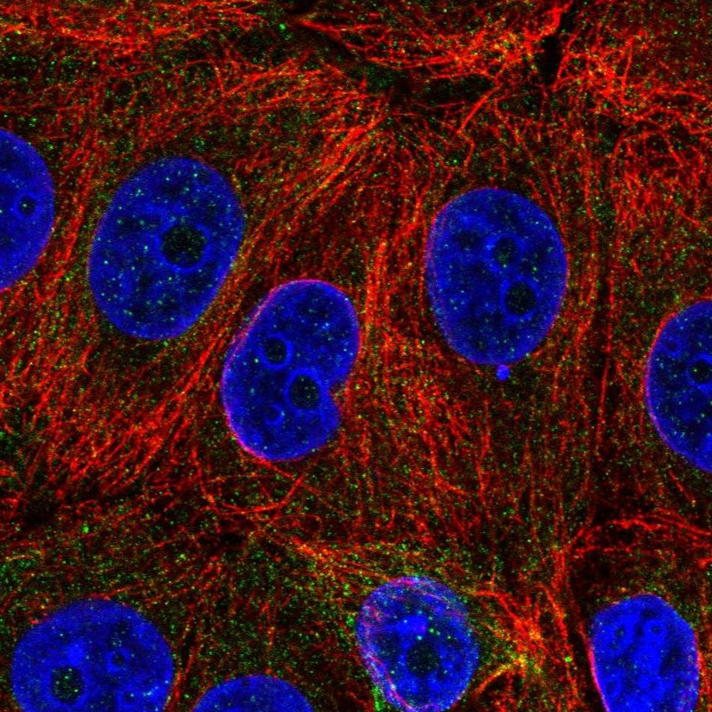 Immunofluorescent staining of human cell line MCF7 shows localization to cytosol.