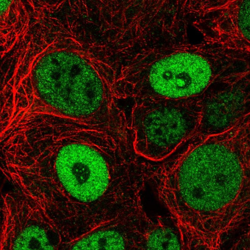 Immunofluorescent staining of human cell line MCF7 shows localization to nucleoplasm & nucleoli.