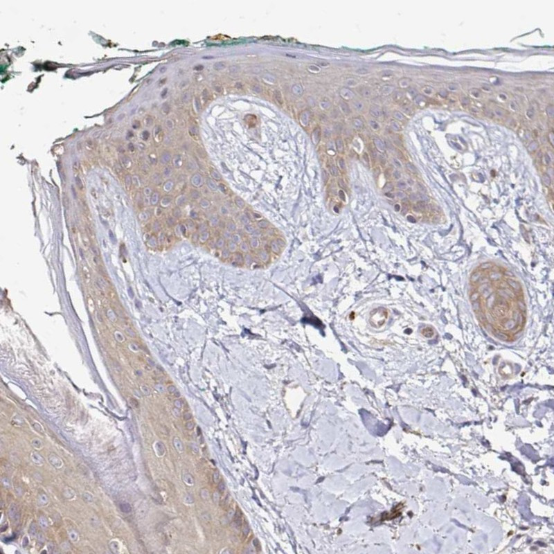 Immunohistochemical staining of human skin shows cytoplasmic positivity in epidermis.