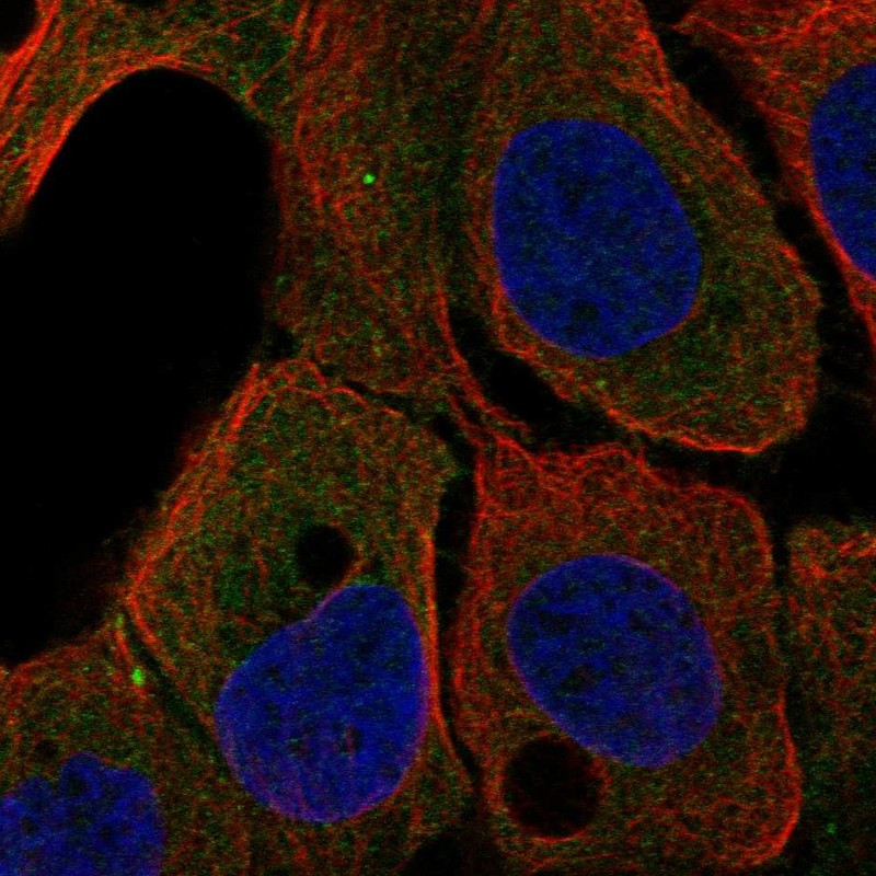 Immunofluorescent staining of human cell line HaCaT shows localization to cytosol.