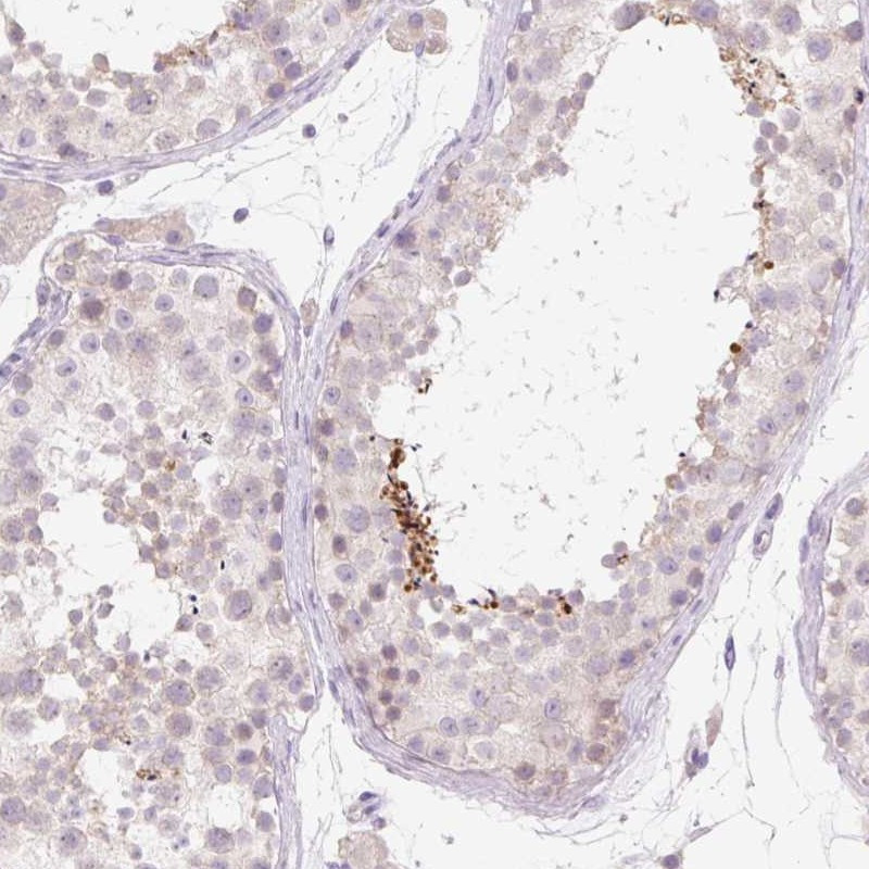 Immunohistochemical staining of human testis shows distinct positivity in spermatozoa.