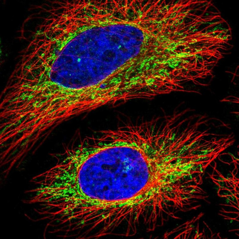 Immunofluorescent staining of human cell line HeLa shows localization to mitochondria.