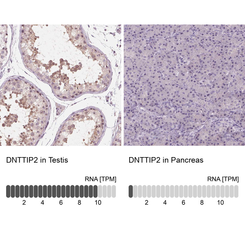 Immunohistochemistry analysis in human testis and pancreas tissues using Anti-DNTTIP2 antibody. Corresponding DNTTIP2 RNA-seq data are presented for the same tissues.