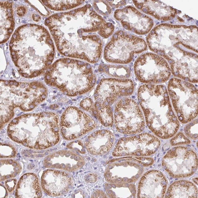 Immunohistochemical staining of human kidney shows strong cytoplasmic positivity in renal tubules.