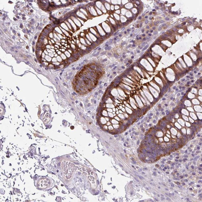Immunohistochemical staining of human colon shows strong cytoplasmic positivity in glandular cells.