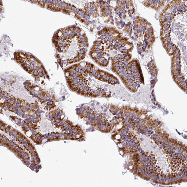 Immunohistochemical staining of human duodenum shows strong granular cytoplasmic positivity in glandular cells.