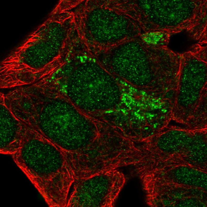 Immunofluorescent staining of human cell line RT4 shows localization to nucleus & mitochondria.
