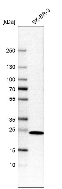 Western blot analysis in human cell line SK-BR-3.