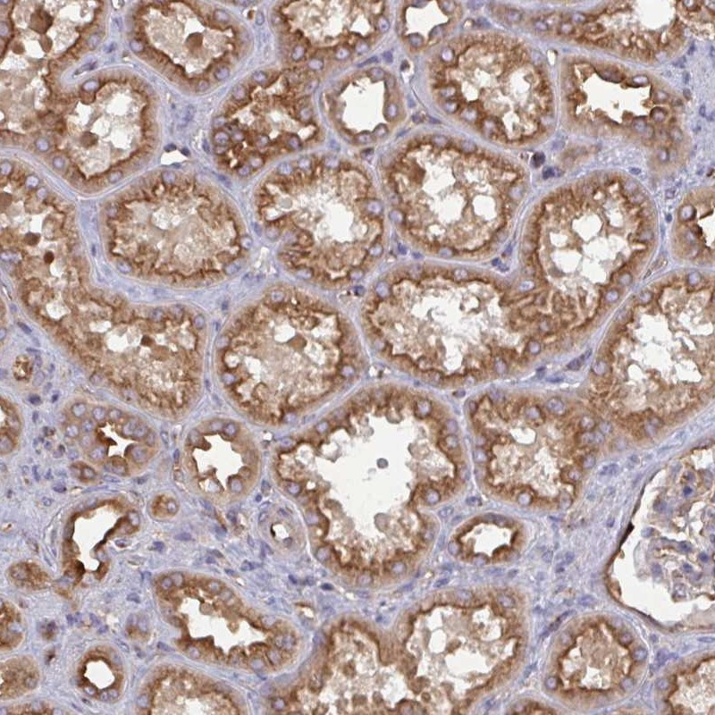 Immunohistochemical staining of human kidney shows strong cytoplasmic and membranous positivity in cells in tubules.