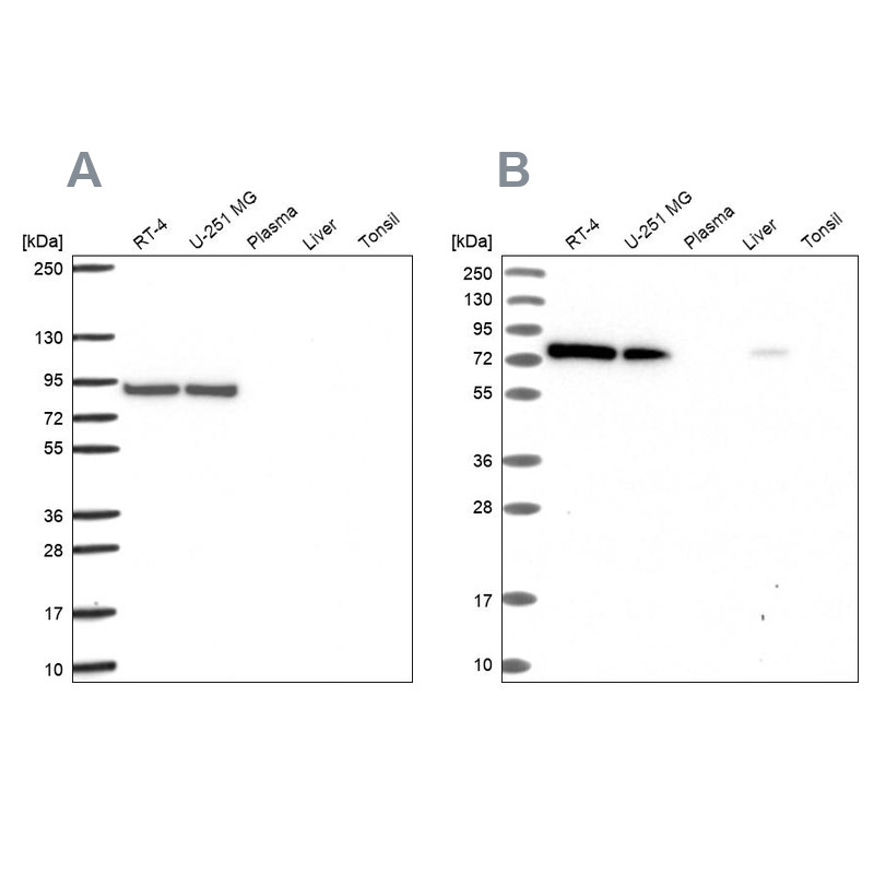 Western blot analysis using Anti-DYNC1I2 antibody HPA053987 (A) shows similar pattern to independent antibody HPA040619 (B).
