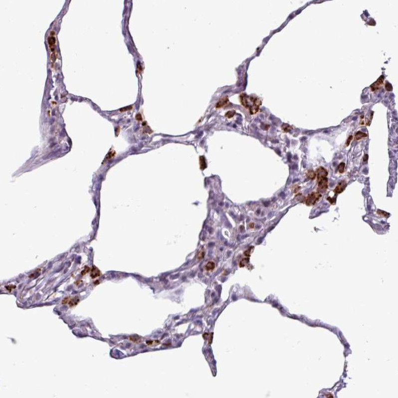 Immunohistochemical staining of human lung shows strong granular cytoplasmic positivity in macrophages.