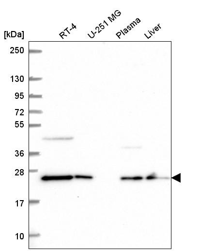 Western blot analysis in human cell line RT-4, human cell line U-251 MG, human plasma and human liver tissue.
