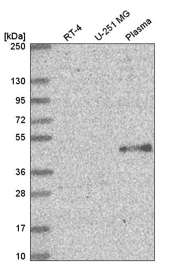 Western blot analysis in human cell line RT-4, human cell line U-251 MG and human plasma.