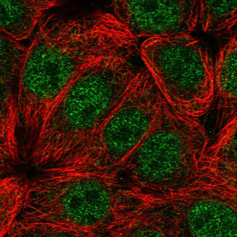 Immunofluorescent staining of human cell line MCF7 shows localization to nucleoplasm.
