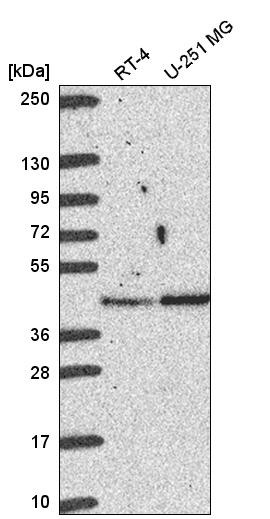 Western blot analysis in human cell line RT-4 and human cell line U-251 MG.