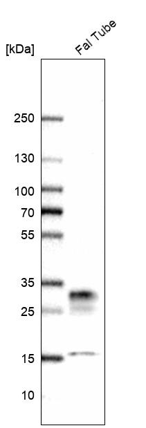 Western blot analysis in human fallopian tube tissue.