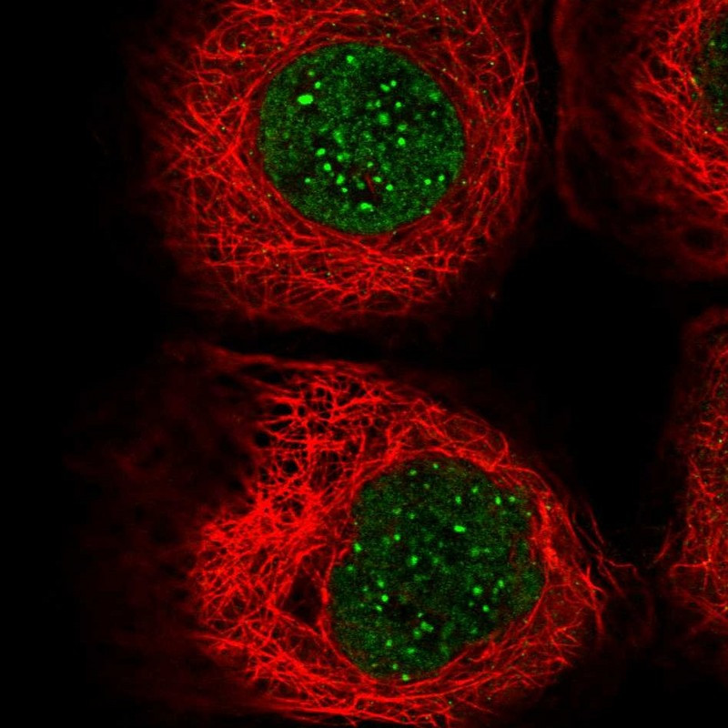Immunofluorescent staining of human cell line A-431 shows localization to nuclear bodies.