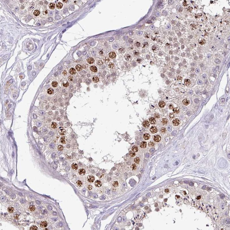 Immunohistochemical staining of human testis shows nuclear positivity in a subset of cells in seminiferus ducts.