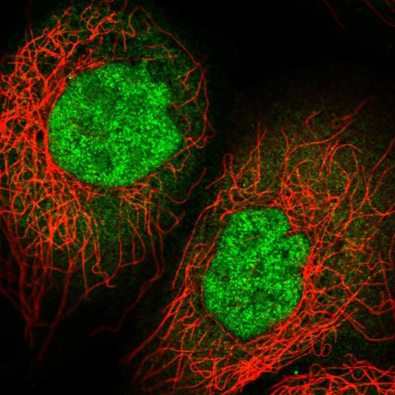 Immunofluorescent staining of human cell line A-431 shows localization to nucleus & cytosol.