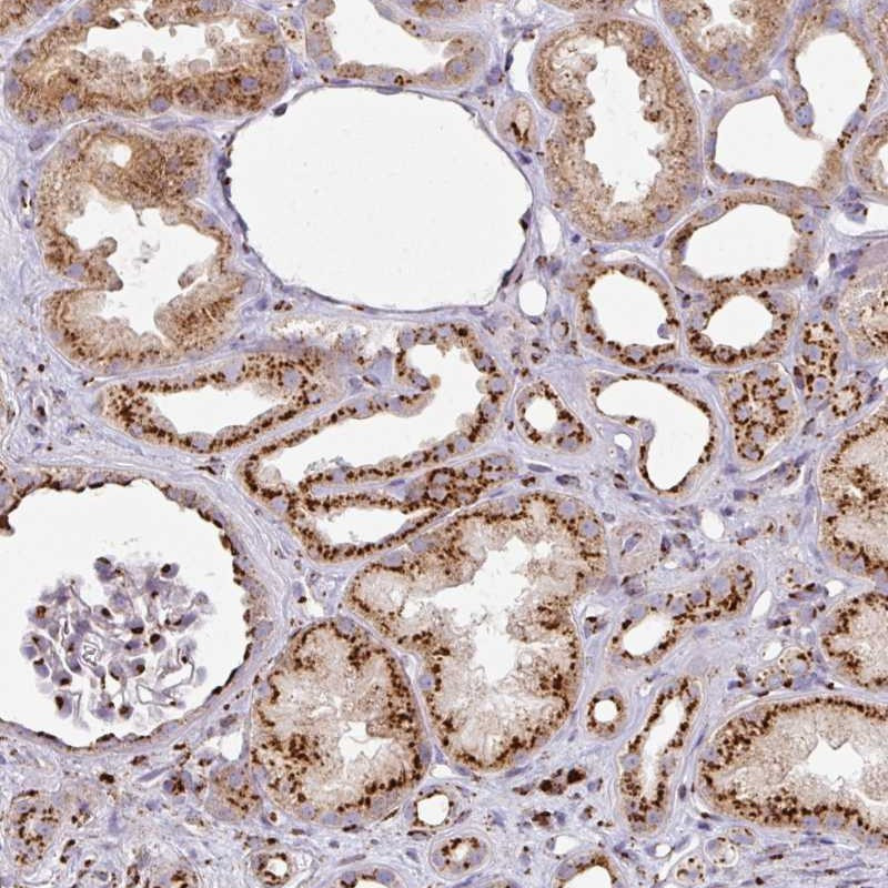 Immunohistochemical staining of human kidney shows strong dot like cytoplasmic positivity in cells in tubules and cells in glomeruli.