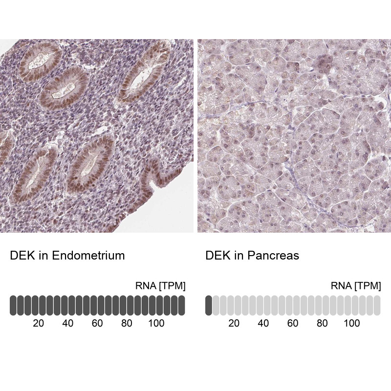 Immunohistochemistry analysis in human endometrium and pancreas tissues using Anti-DEK antibody. Corresponding DEK RNA-seq data are presented for the same tissues.