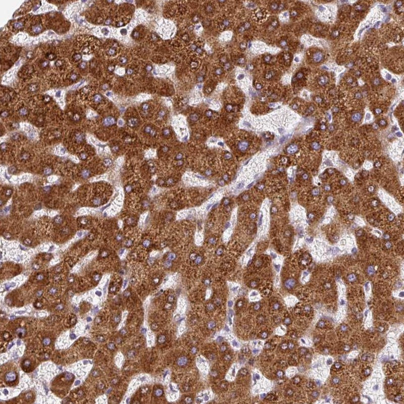Immunohistochemical staining of human liver shows strong cytoplasmic positivity in hepatocytes.