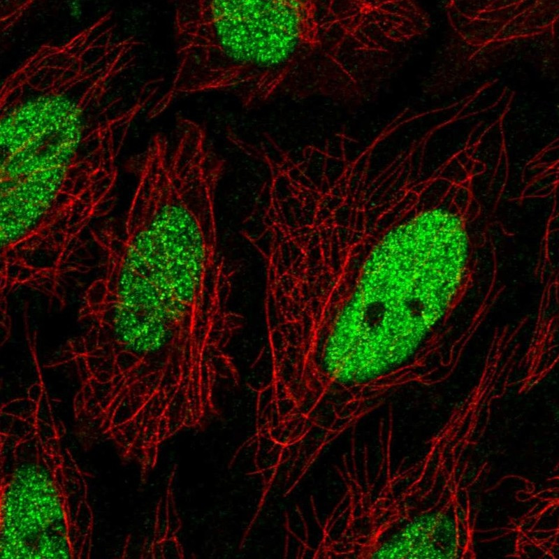 Immunofluorescent staining of human cell line SiHa shows localization to nucleoplasm.