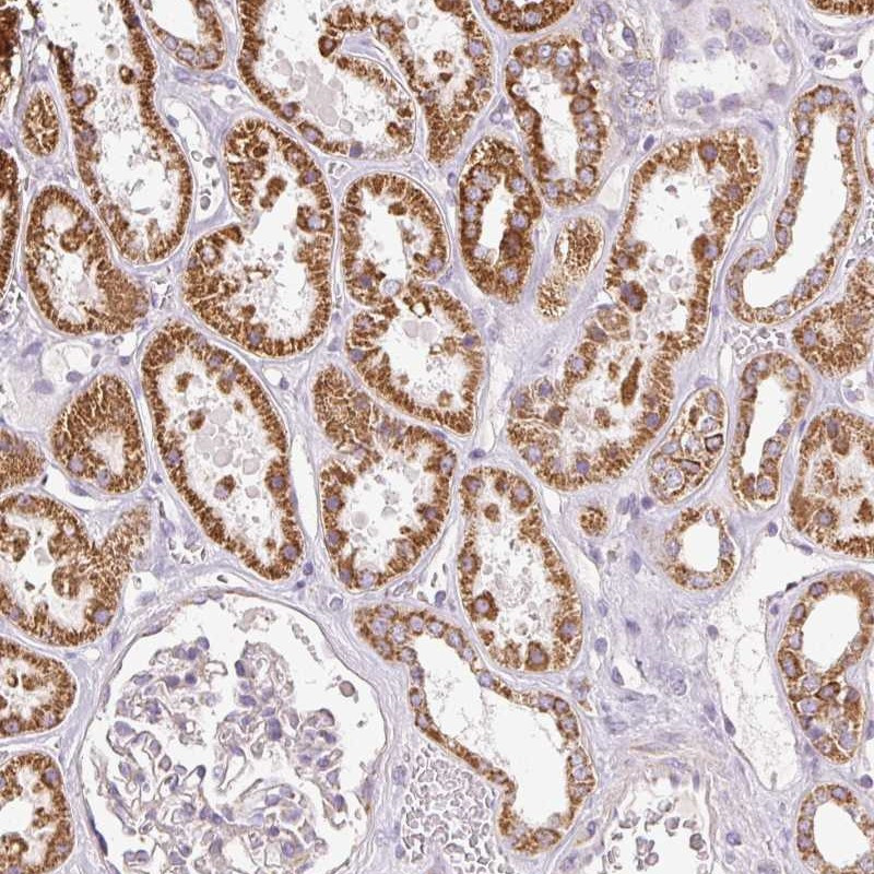 Immunohistochemical staining of human kidney shows strong cytoplasmic positivity in renal tubules.