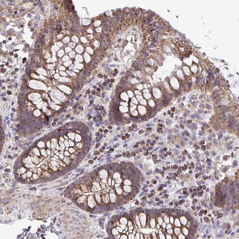 Immunohistochemical staining of human colon shows moderate cytoplasmic positivity in glandular cells.