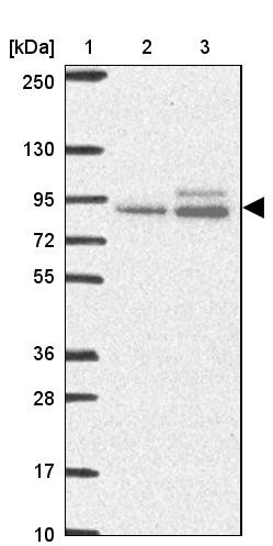 Lane 1: Marker [kDa] 250, 130, 95, 72, 55, 36, 28, 17, 10<br/>Lane 2: Human cell line RT-4<br/>Lane 3: Human cell line U-251MG sp