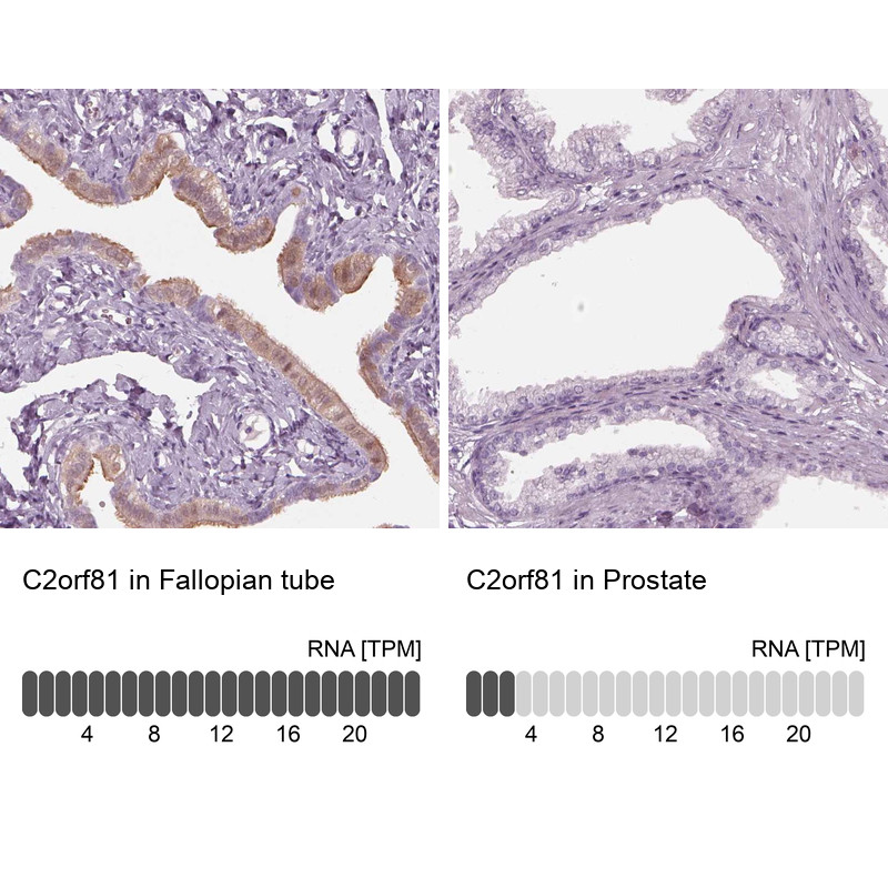 Immunohistochemistry analysis in human fallopian tube and prostate tissues using Anti-C2orf81 antibody. Corresponding C2orf81 RNA-seq data are presented for the same tissues.
